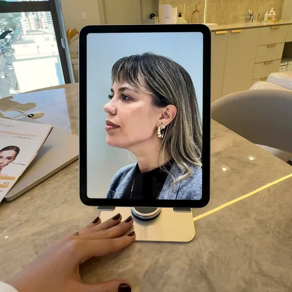 Foto de perfil de uma paciente no tablet, sobre a mesa da clínica, para a análise facial